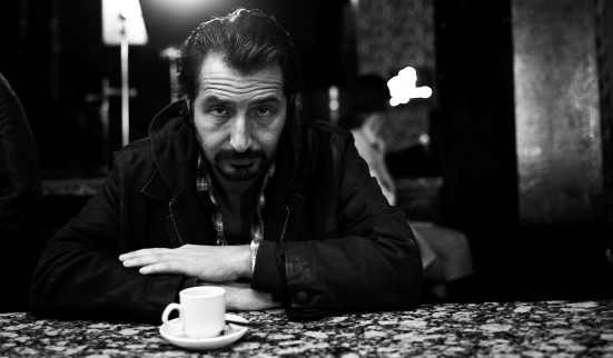 Casting de luxe pour bras cassés