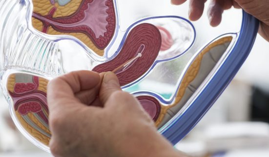 Des stérilets à régler cash chez le gynéco 1