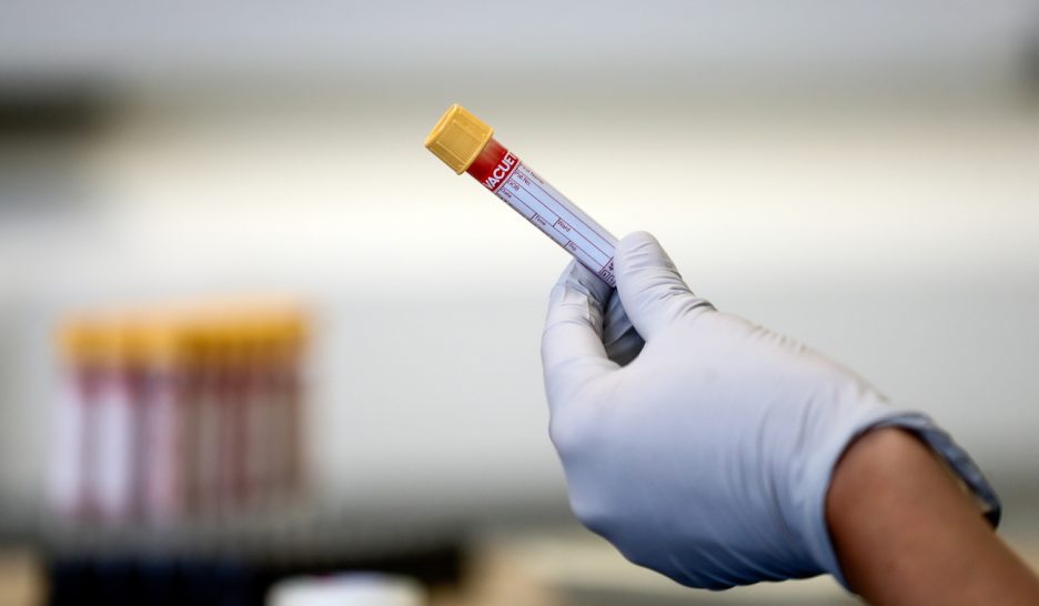 Covid-19: les tests à petits pas