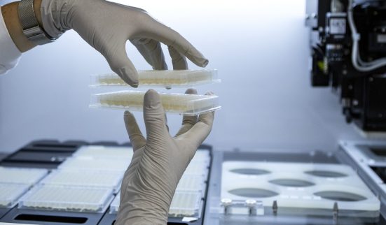 Le vaccin est arrivé en Suisse